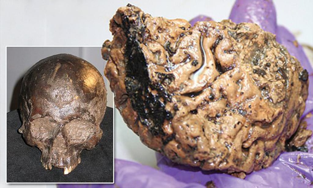 Researchers discover 12,000-year-old preserved human brains