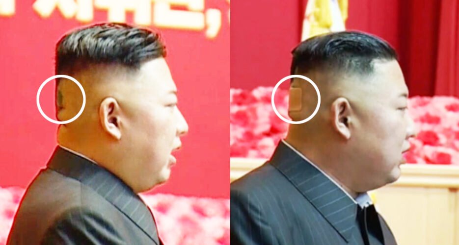 Kim Jong Un