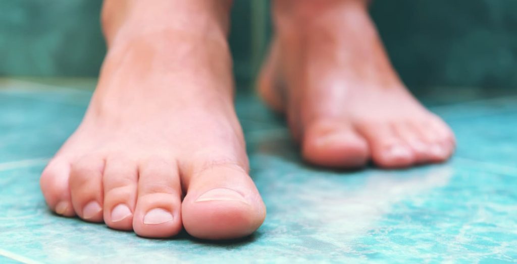 Toe nail fungus