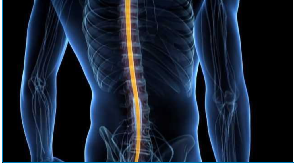 spinal implants