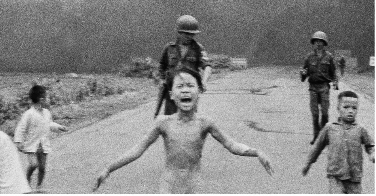 Vietnamese ‘Napalm Girl’ gets final skin treatment 50 years after the iconic photo
