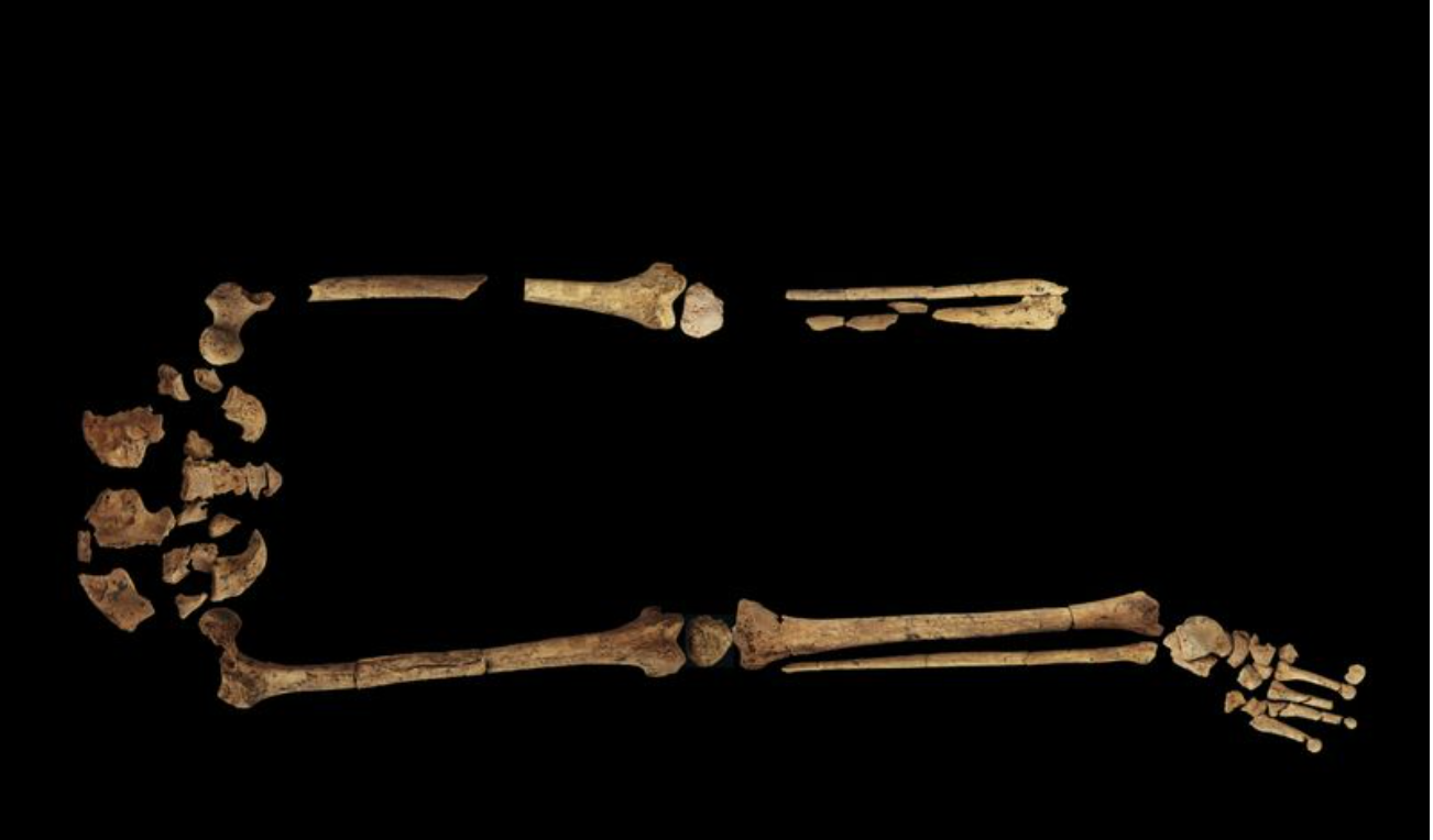 Ancient Borneo skeleton indicates amputation surgery 31,000 years ago
