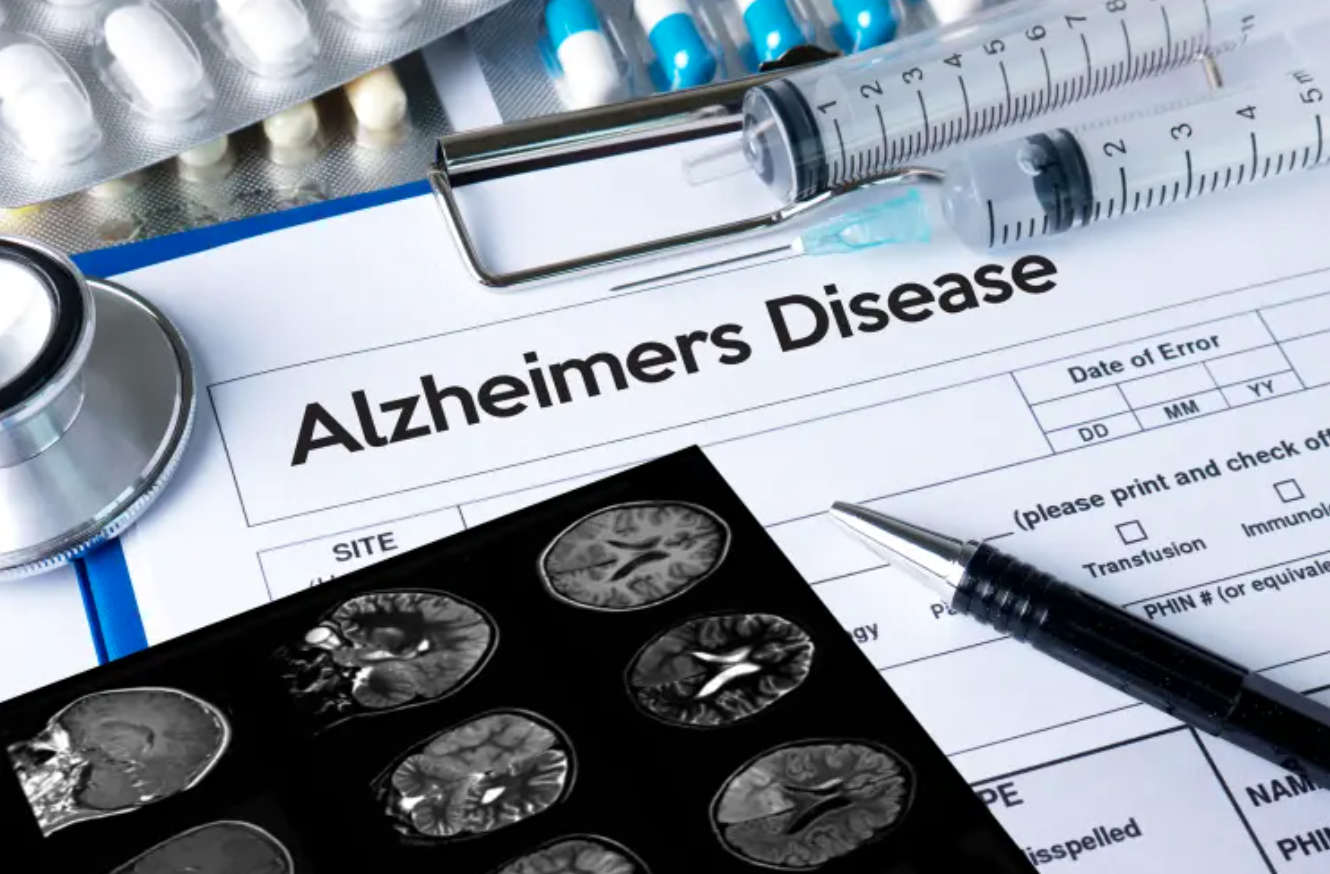 Lecanemab: US FDA Approves New ‘breakthrough’ Medicine For Alzheimer’s ...