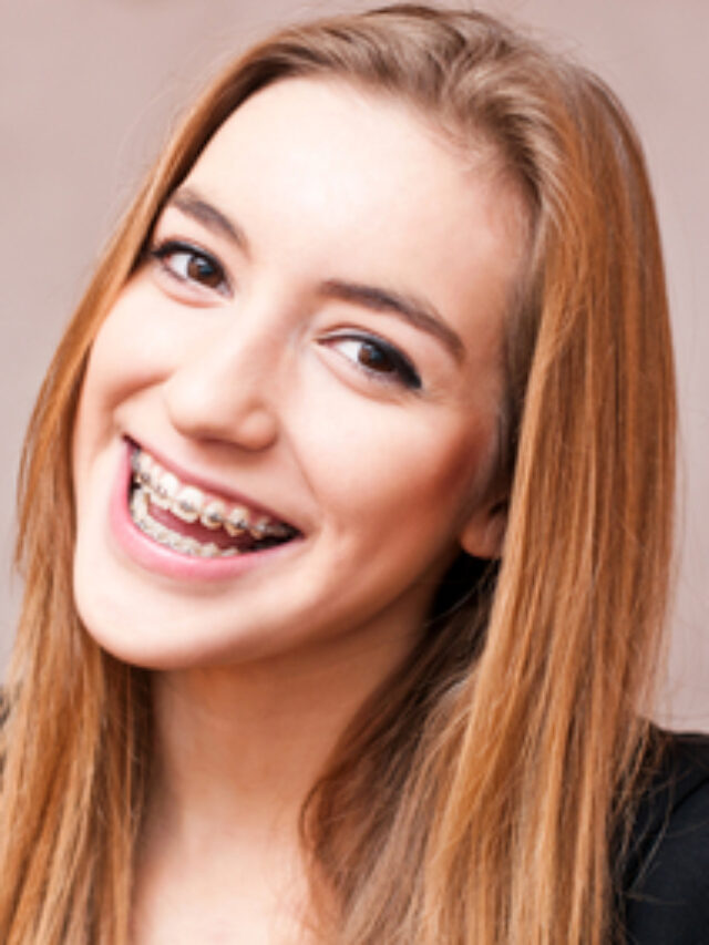 Reasons Why You Might Need Braces Breezyscroll