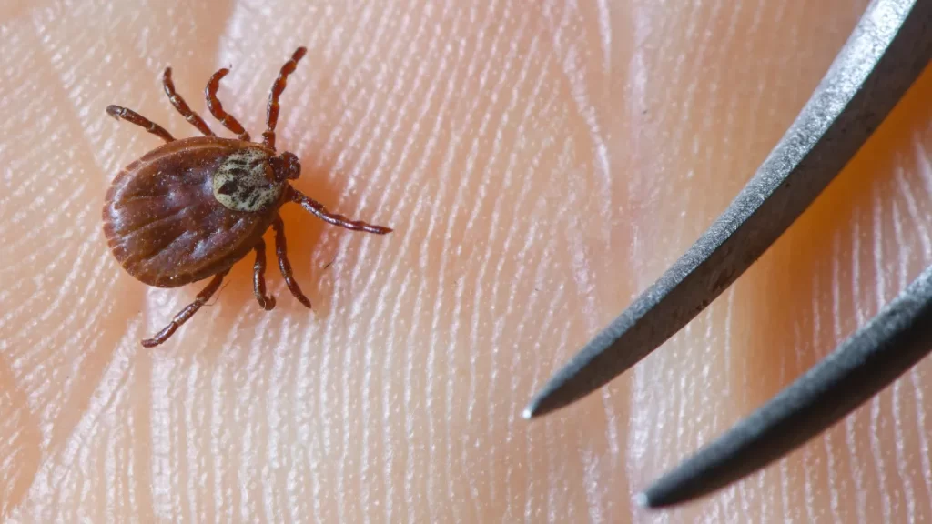 Tick-borne encephalitis spreading in the UK due to climate change