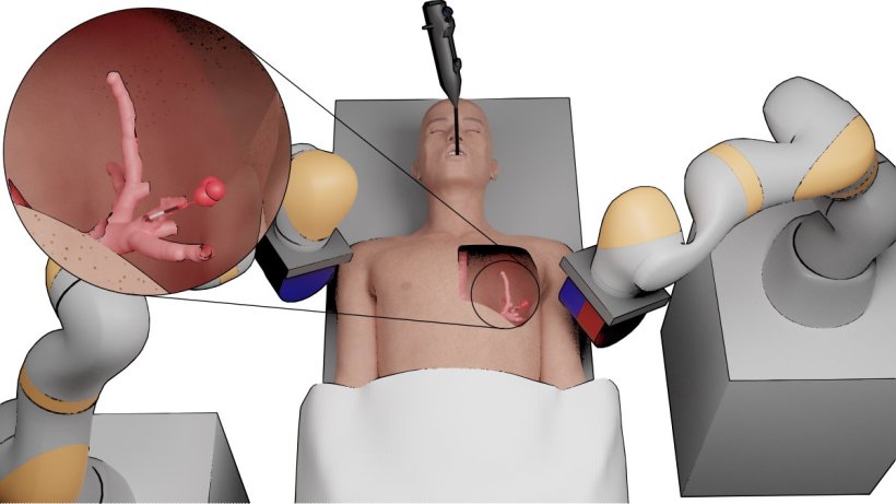 Tiny magnetic robots detect and treat cancer by diving deep into the lungs