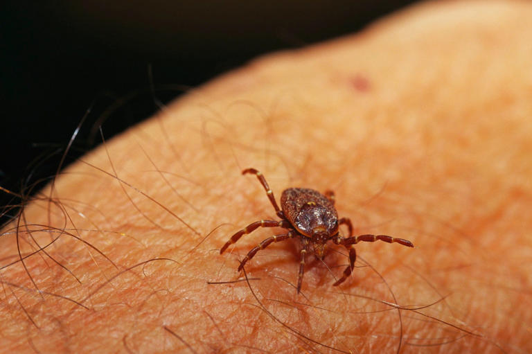 Man dies in Spain after contracting Crimean-Congo hemorrhagic fever from tick bite- Symptoms and prevention