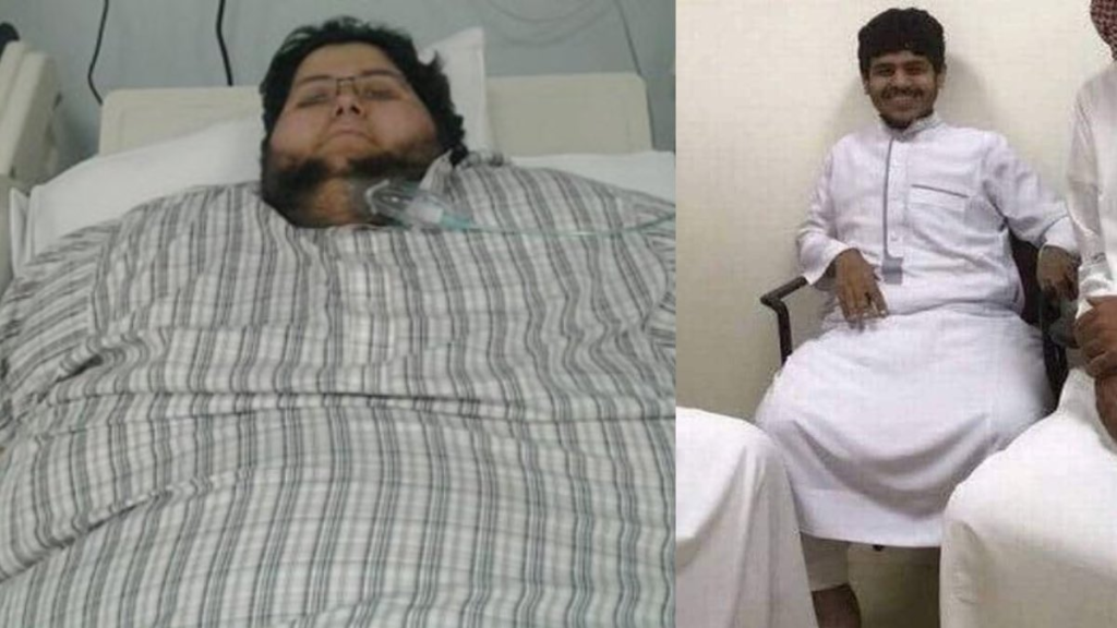 World's heaviest man alive loses 1,195 pounds in historic transformation