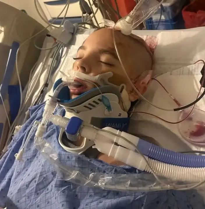 Utah: Dangerous TikTok trend leaves 15-year-old in coma after falling from top of moving vehicle