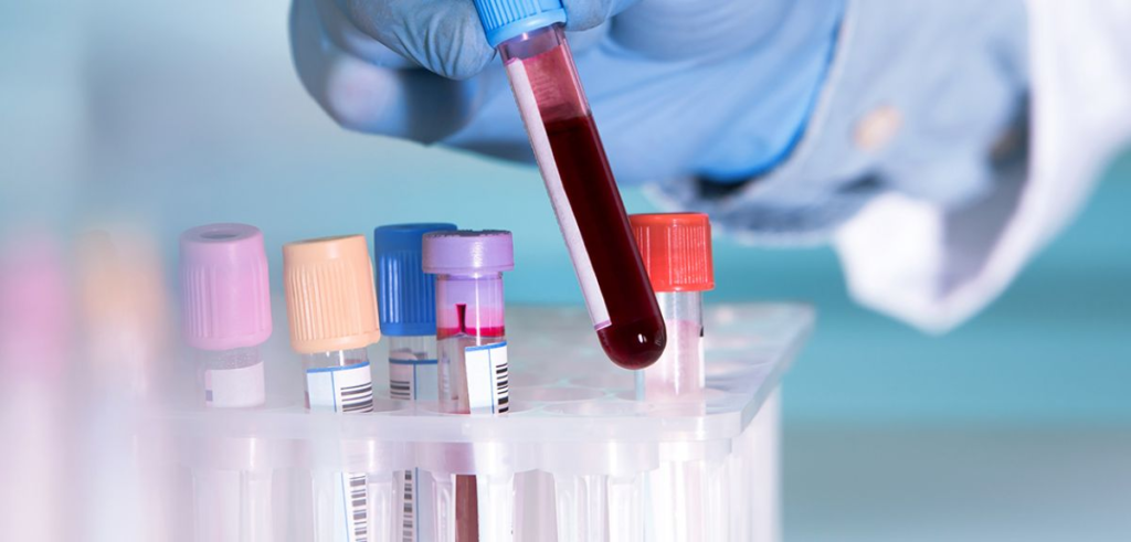 UK: This revolutionary blood test can detect 12 types of cancer. All you need to know