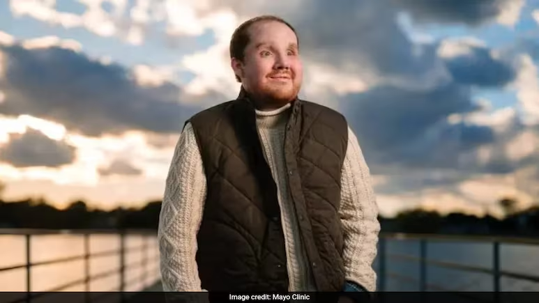 Michigan man receives successful rare face transplant after suicide attempt