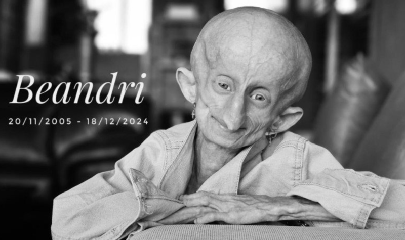 What is Progeria? TikTok star Beandri Booysen, who documented her battle with the rare rapid aging disease, dies at 19