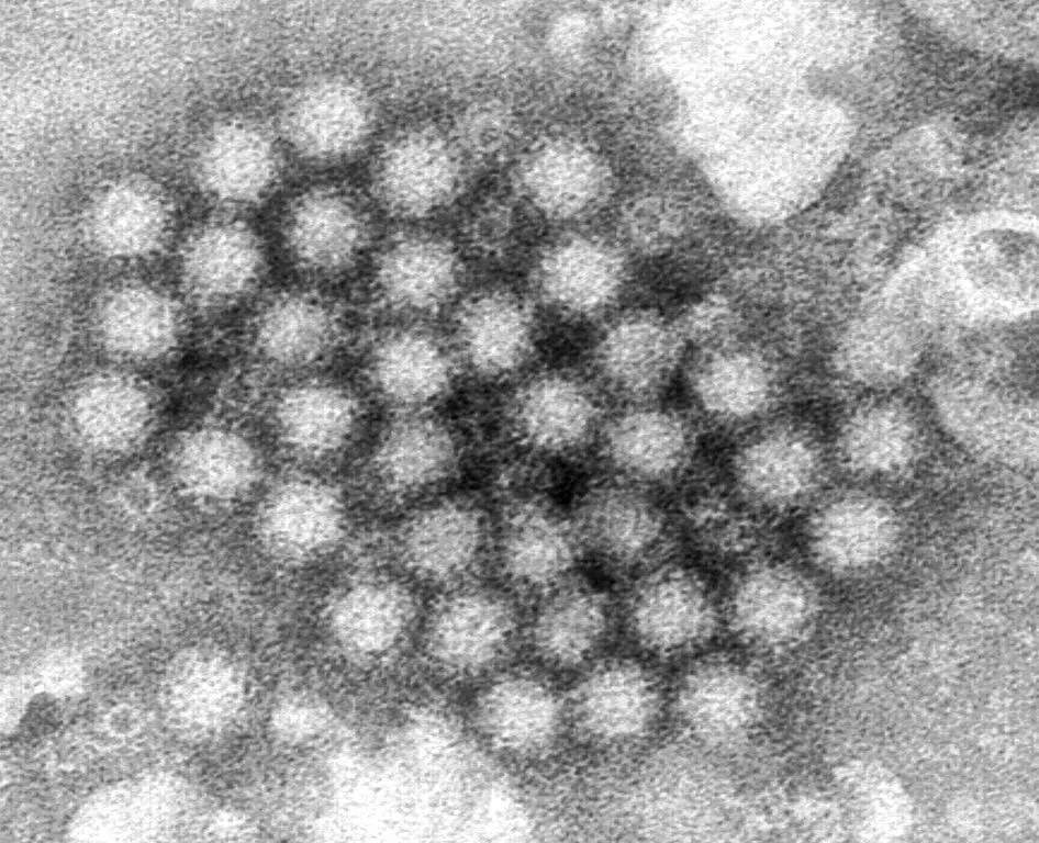 Norovirus cases double in the US: What you need to know