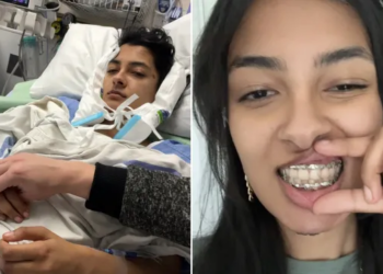 Canadian student eats jawbreaker candy, ends up splitting her jaw in two