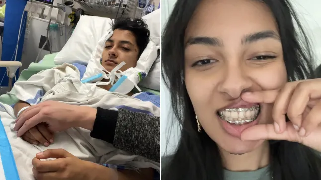 Canadian student eats jawbreaker candy, ends up splitting her jaw in two