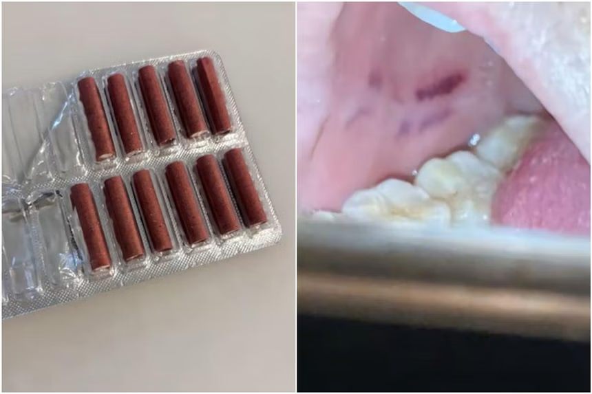 Chinese woman mistakenly eats firecracker thinking it was candy, suffers injuries